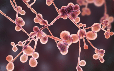 Natural Medicine Approaches to Candidiasis
