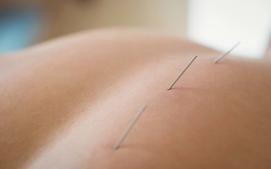 Traditional Chinese Medicine and Kidney Health